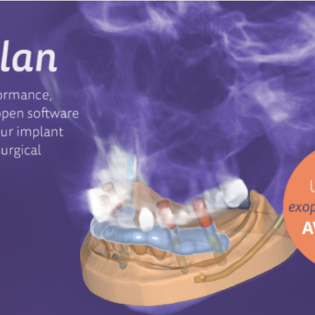 Exoplan